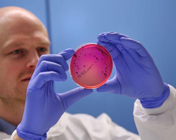 Betrachtung von Keimkolonien auf einer Selektivplatte.