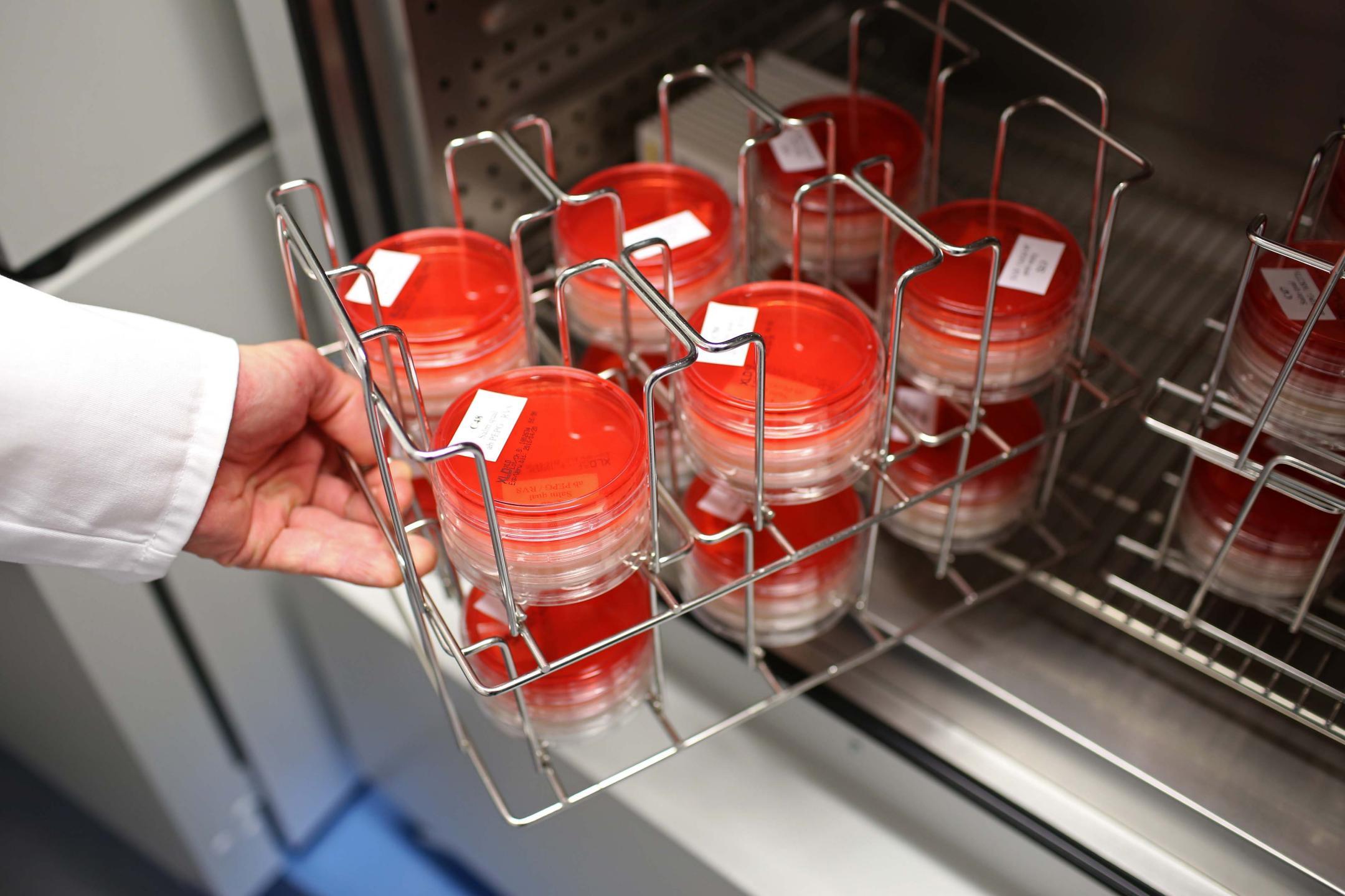 Eine Kontrolle des Labors: Mikrobiologie.