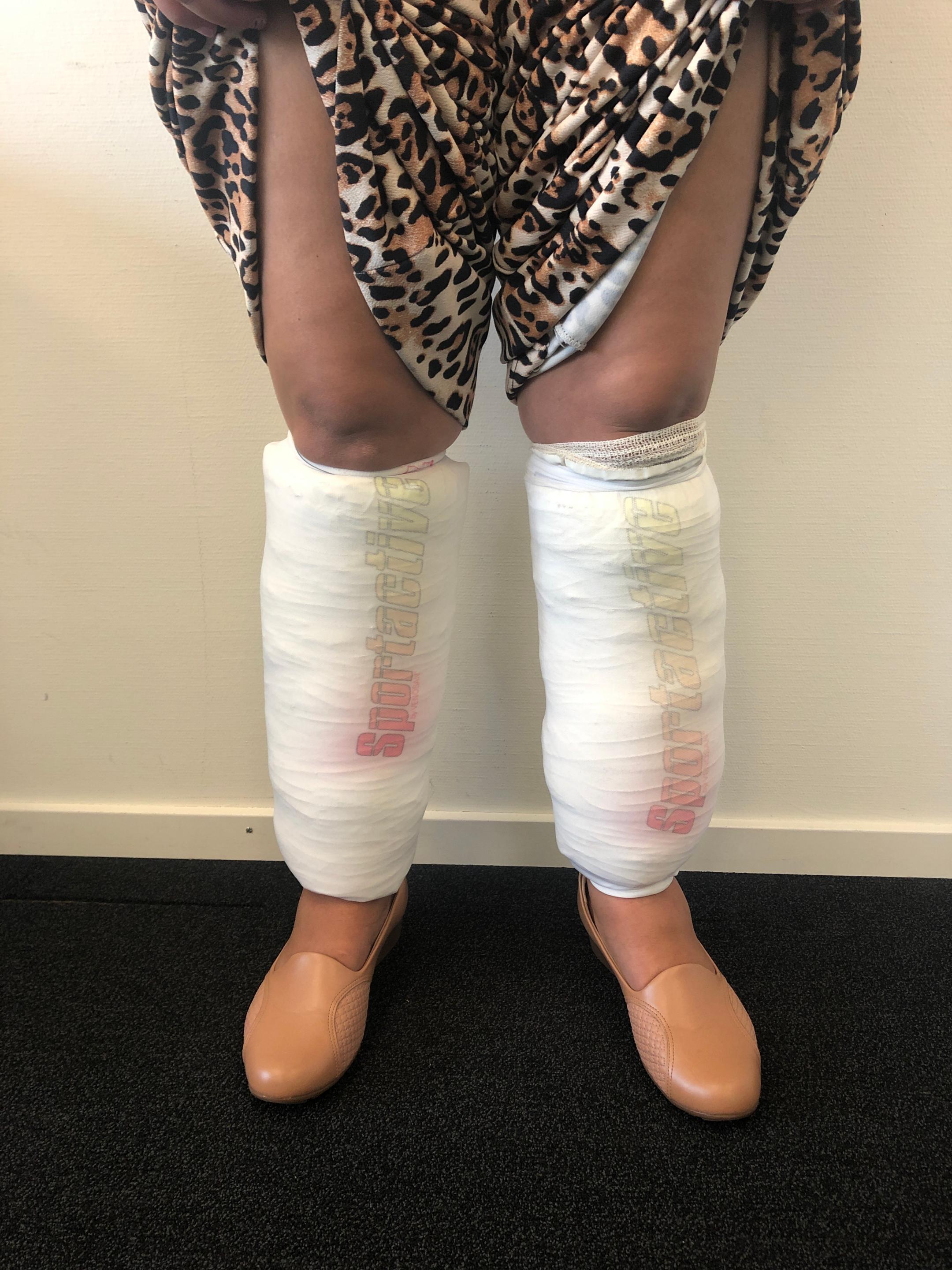 Die Drogenkurierin und ihr Schmuggelversteck.