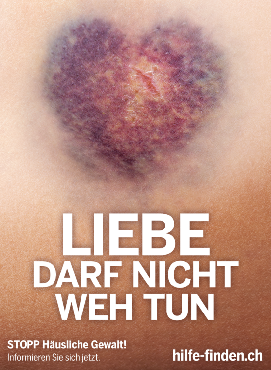 Hämatom in Form eines Herzens 