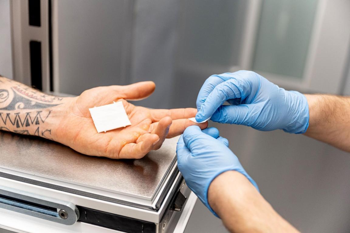 Einer inhaftierten Person wird durch die Zellenklappe am Finger Blut abgenommen. Die Person, die Blut abnimmt, trägt blaue Gummihandschuhe.