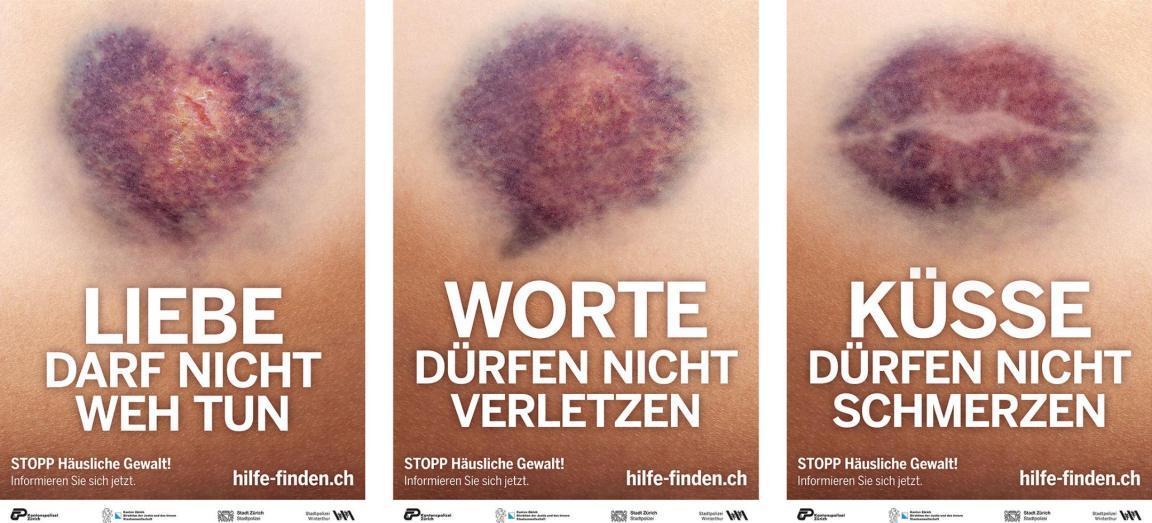 Bildliche Darstellung von drei Hämatomen auf der Haut. Ein Hämatom in Form eines Herz, dazu der Text Liebe darf nicht weh tun, ein Hämatom in Form einer Sprechblase, dazu der Text Worte dürfen nicht verletzen, und ein Hämatom in Form eines Mundes, dazu der Text Küsse dürfen nicht schmerzen.