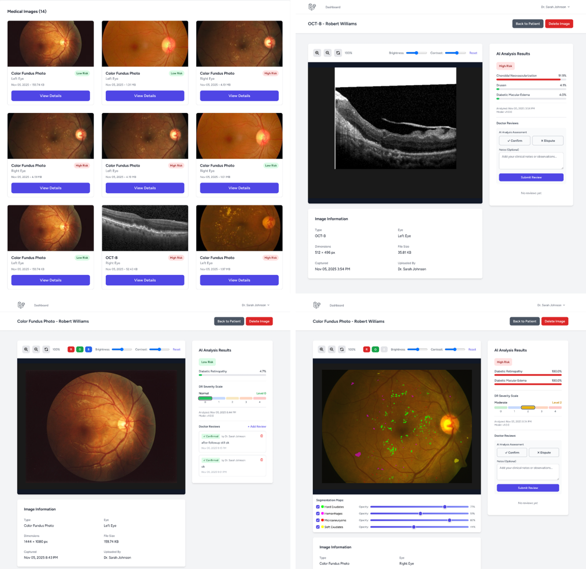 Bildschirmaufnahmen von Benutzeroberflächen bei Augenuntersuchung