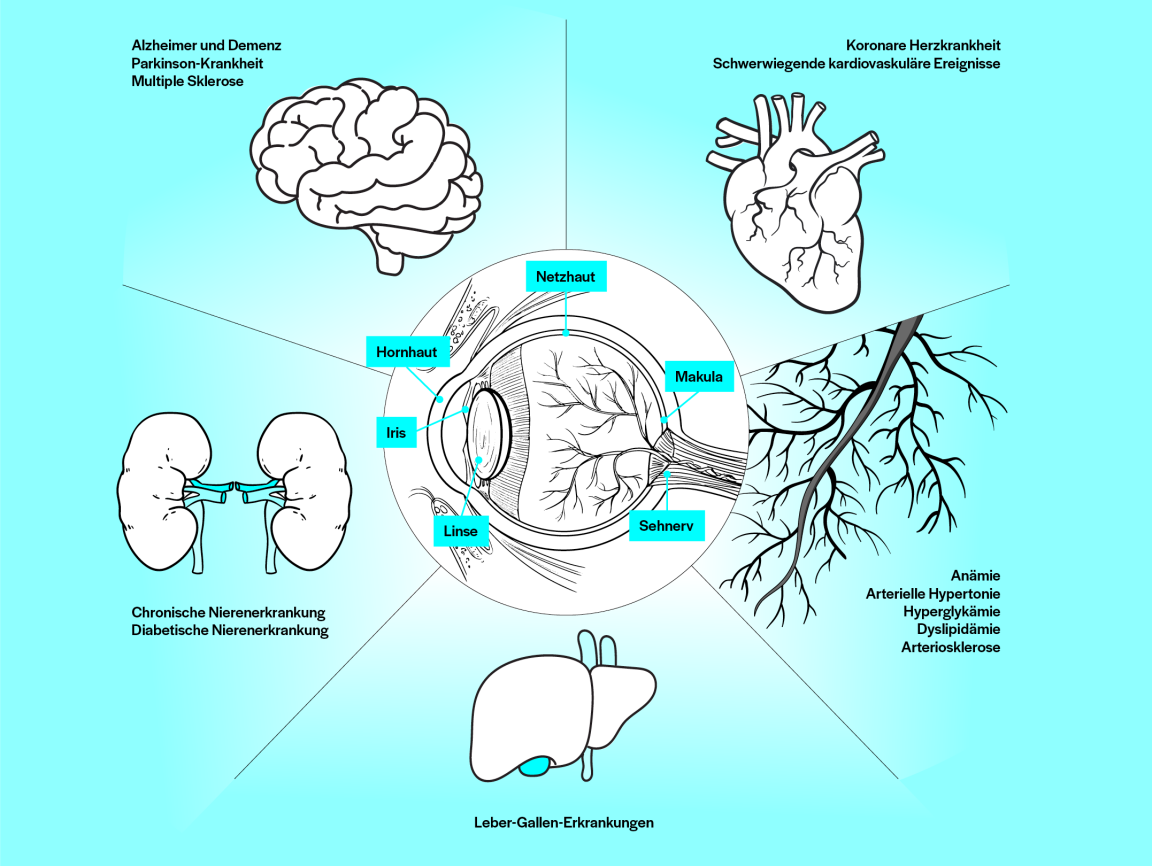 Gesundheitszusammenhänge von Organen mit Augenbestandteilen