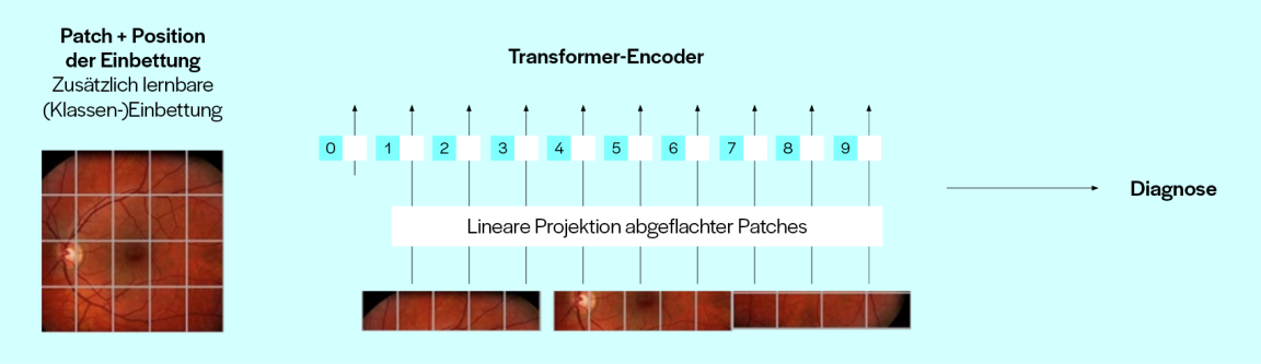 Transformer Encoder 