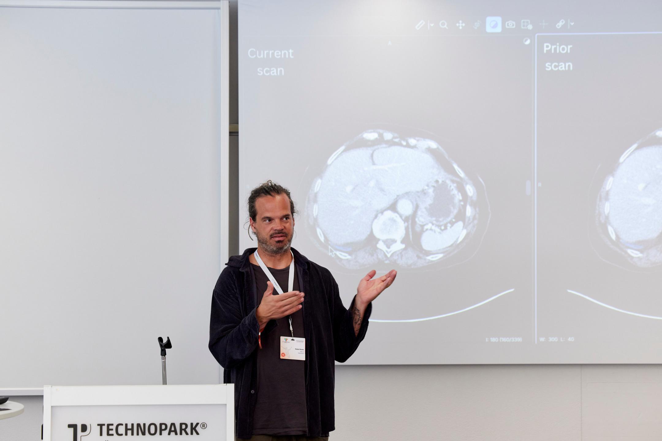 Vor einer Leinwand, auf der zwei Gehirne im seitlichen Querschnitt dargestellt sind, steht Robert Berke und spricht.