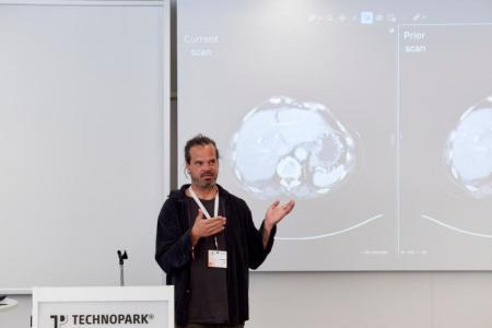 Vor einer Leinwand, auf der zwei Gehirne im seitlichen Querschnitt dargestellt sind, steht Robert Berke und spricht.